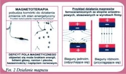 Opaska magnetyczna na bóle głowy